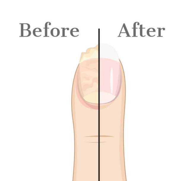 Nail Doctor